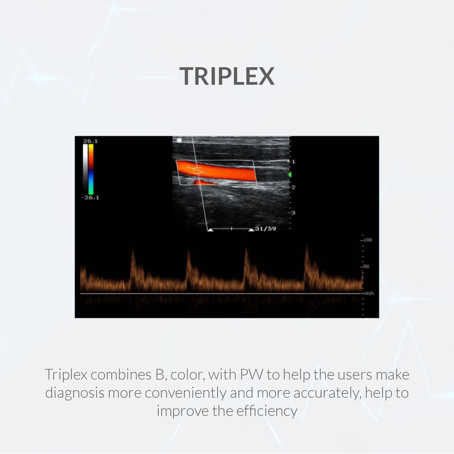 iCare® Sonolepu LP3-Plus Diagnostic Ultrasound System Portable, Ultra-Lightweight