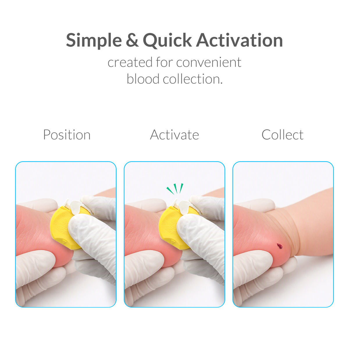 iCare SafeEdge Neo Heel Incision Safety Lancet for Newborn Blood Sampling, Sterile, Single-Use, Latex Free, Comfort Grip, Safety Engineered